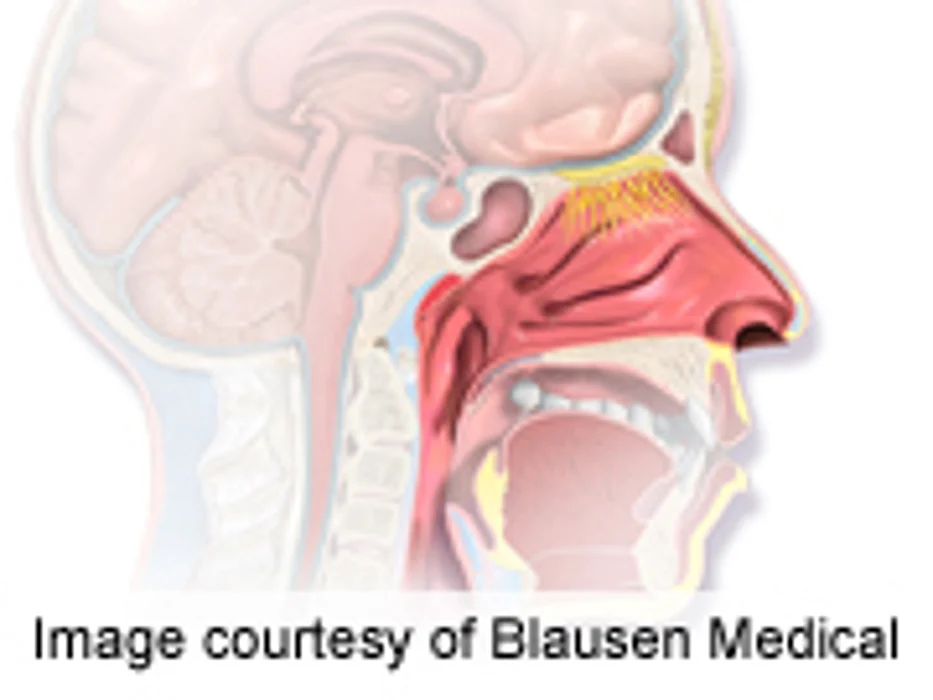 Study Compares Treatment Options for Nose Bleeds