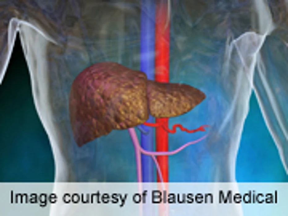 AACR: Coffee Consumption Linked to Lower Liver Cancer Risk