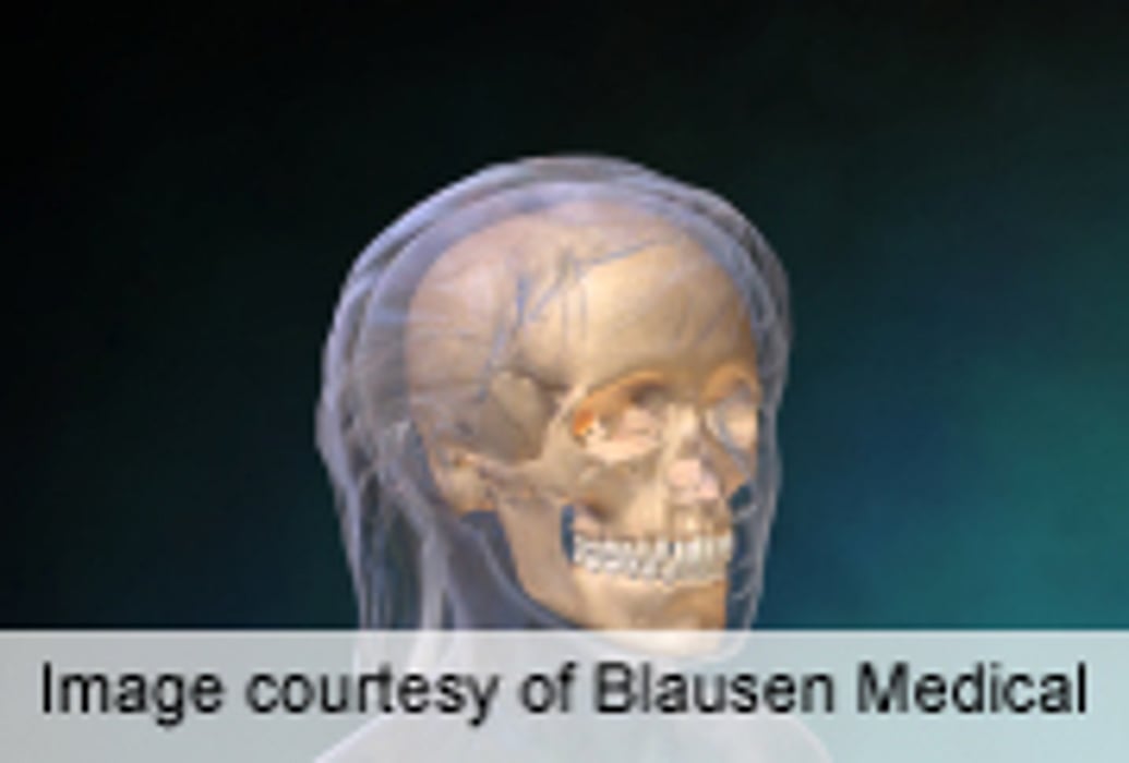 Increased Health Care Use With Concussion Legislation