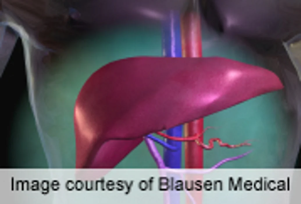 Non-Interferon Regimen Found Effective for Hepatitis C