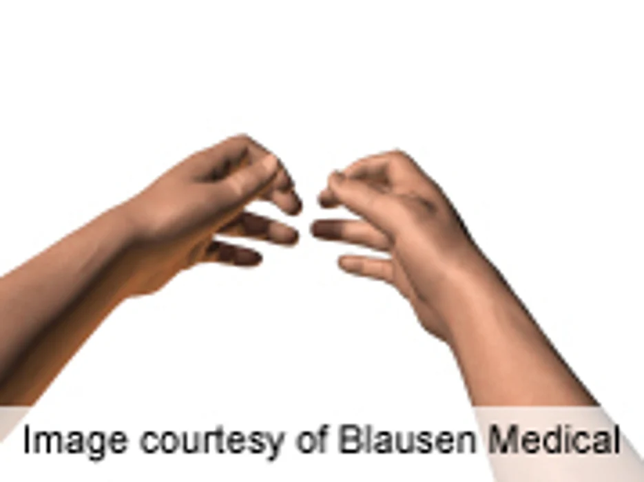 AHA: Virtual Reality Hands Help Stroke Patients