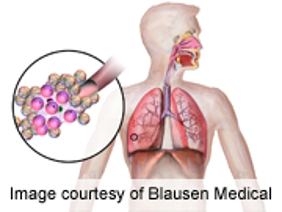 AAP/CDC Update Antibiotic Guidance for Pediatric URIs