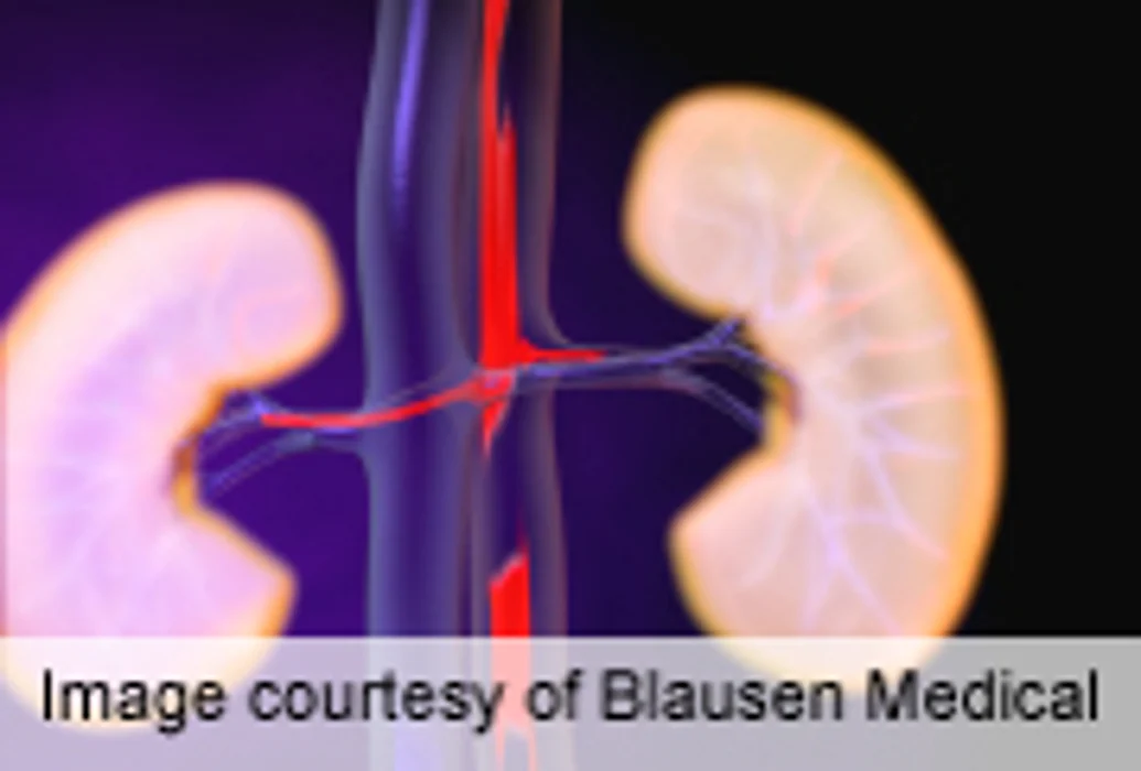 AHA: Stenting No Benefit for Renal-Artery Stenosis