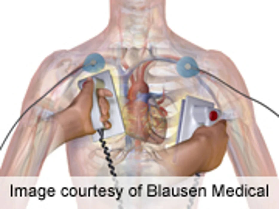 Public Access Defibrillation Underutilized in Cardiac Arrest