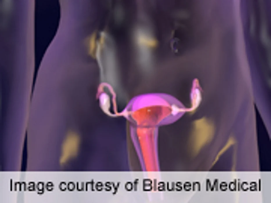Hysterectomy and Ovary Removal Linked to Diabetes Development