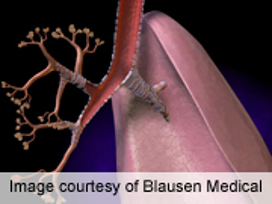 Daily Walks May Cut Risk of Hospitalization for COPD