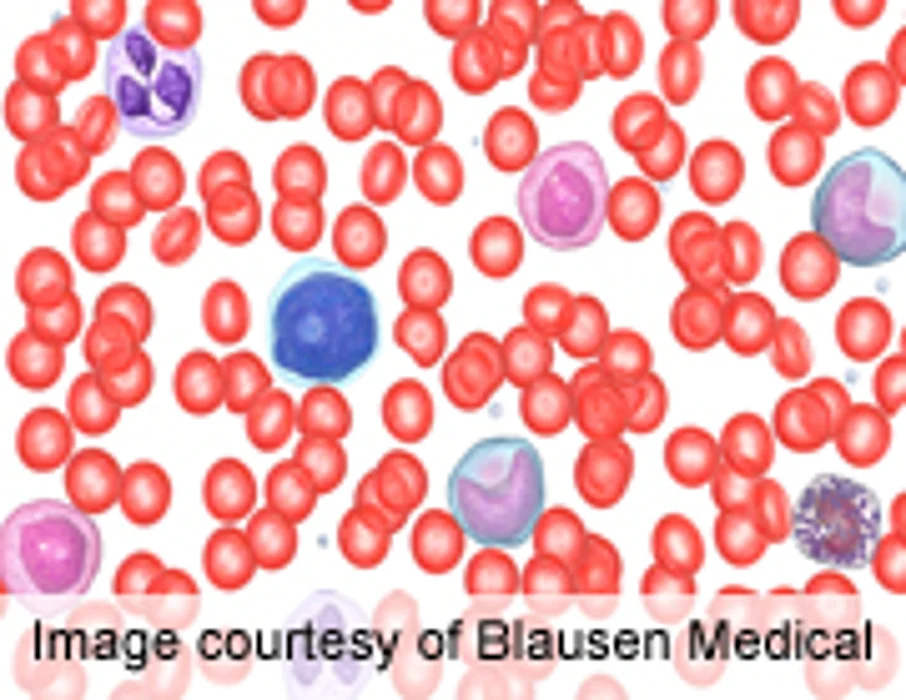 Idelalisib Active in Non-Hodgkin's Lymphoma