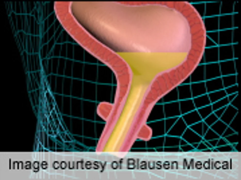 Group-Based Yoga Feasible, Effective for Incontinence