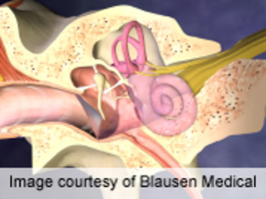 Aspirin Linked to Reduced Growth of Ear Tumors