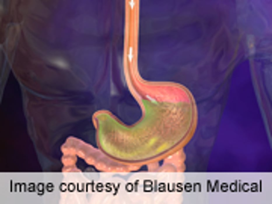 Two New Radiographic Signs of Gastric Band Slippage ID'd