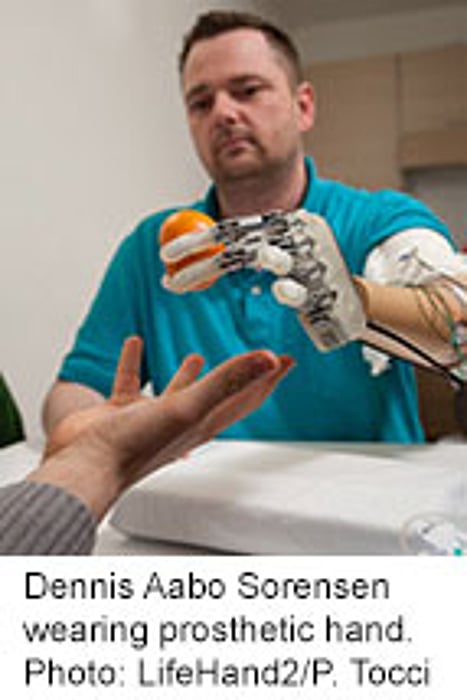Amputee 'Feels' Objects With Prosthetic Hand