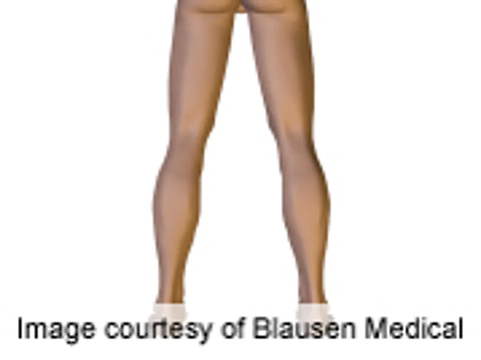 Pregabalin Treatment Effective in Restless Legs Syndrome
