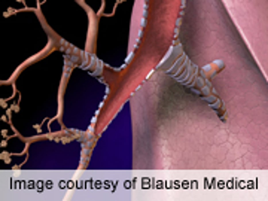 Research Reveals Earlier Diagnosis of COPD Often Missed