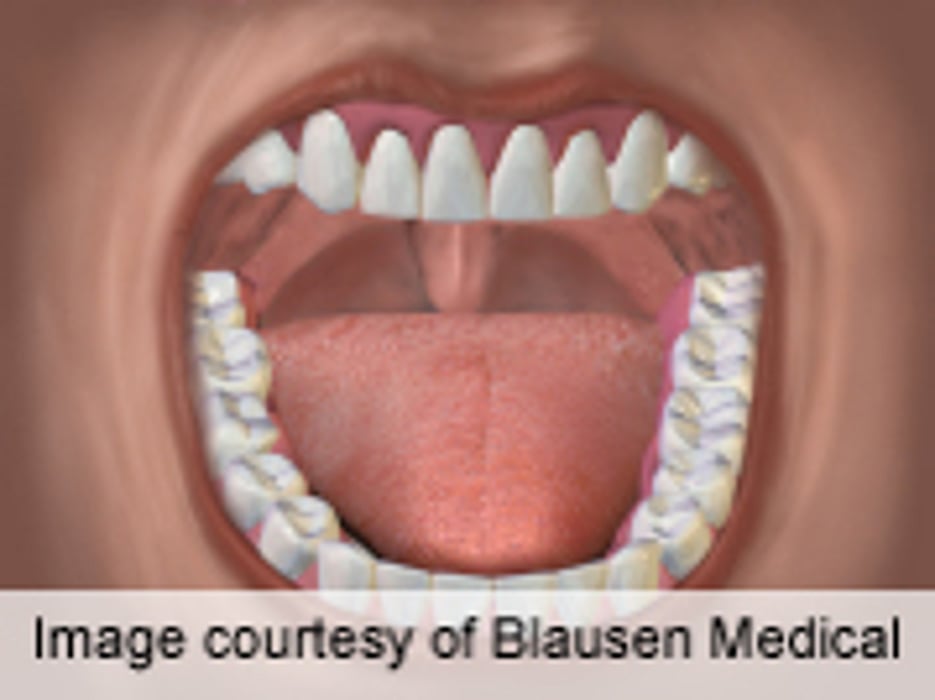 Rituximab Doesn't Alleviate Sjögren Symptoms at Week 24
