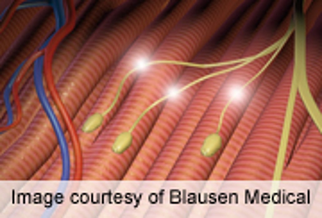 Guidelines Issued for Limb-Girdle Muscular Dystrophies