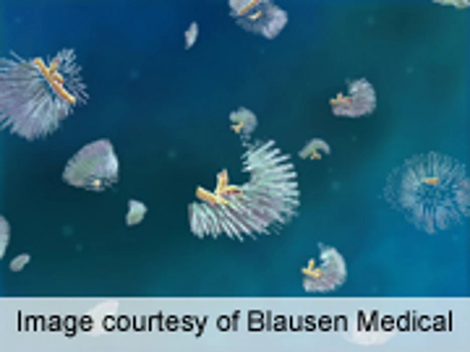 Impact of Rising Incidence of Measles Discussed