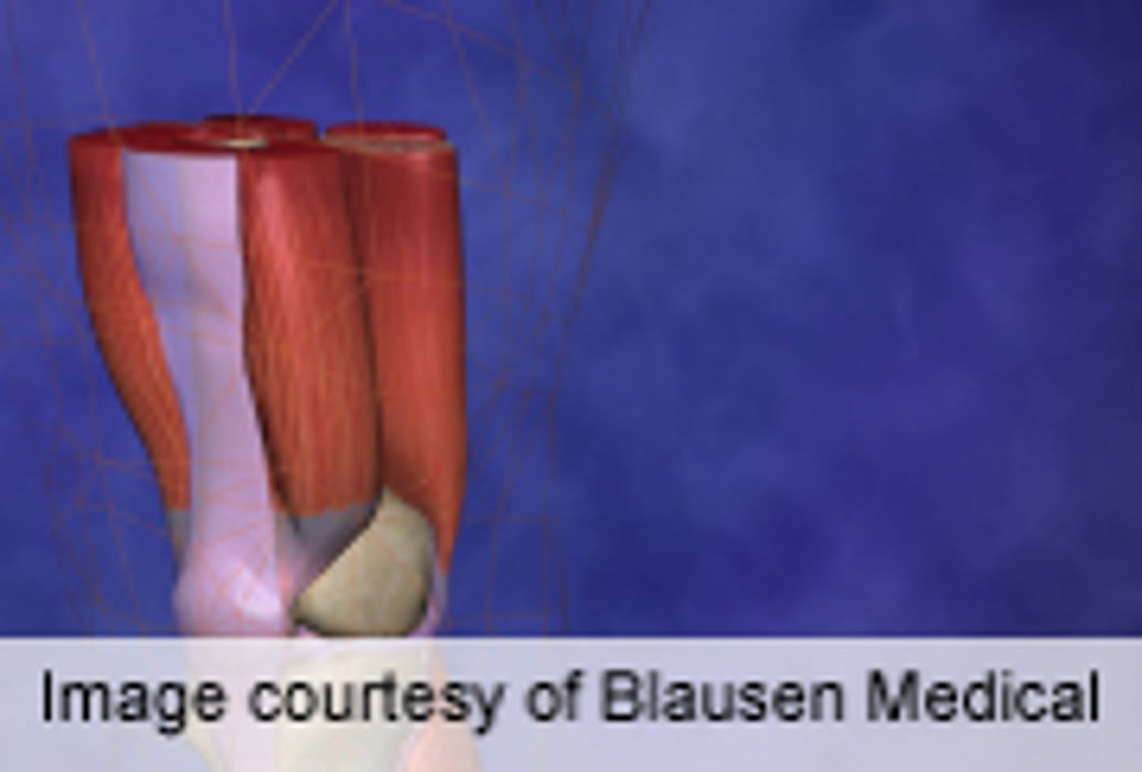 Doctors Regrow Large Areas of Muscle Lost in Injured Soldiers