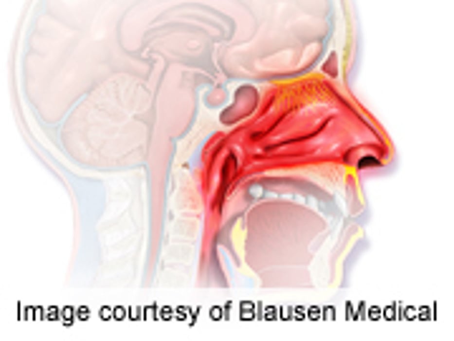Perceived Stress Positively Linked to Allergy Flares