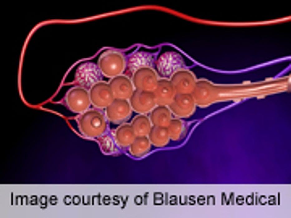 Lower Mortality Tied to Azithromycin for Pneumonia