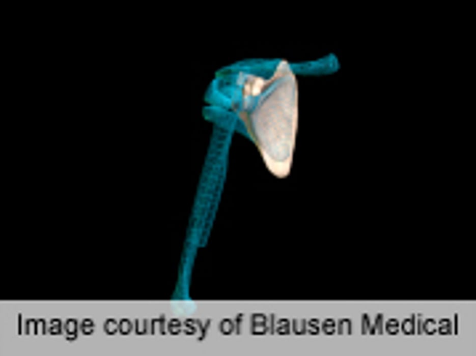 Anatomic Features Not Tied to Pain in Rotator Cuff Tears