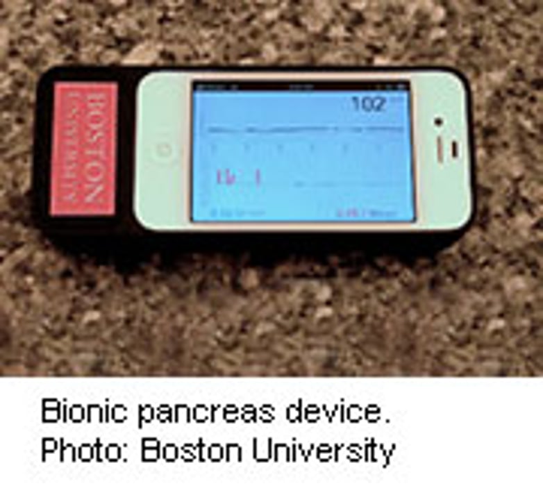 'Bionic Pancreas' Improves Blood Sugar Control for People With Type 1 Diabetes