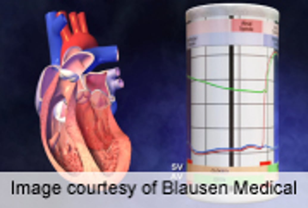 Computerized Tool Cuts Risk of Prolonged QTc Interval