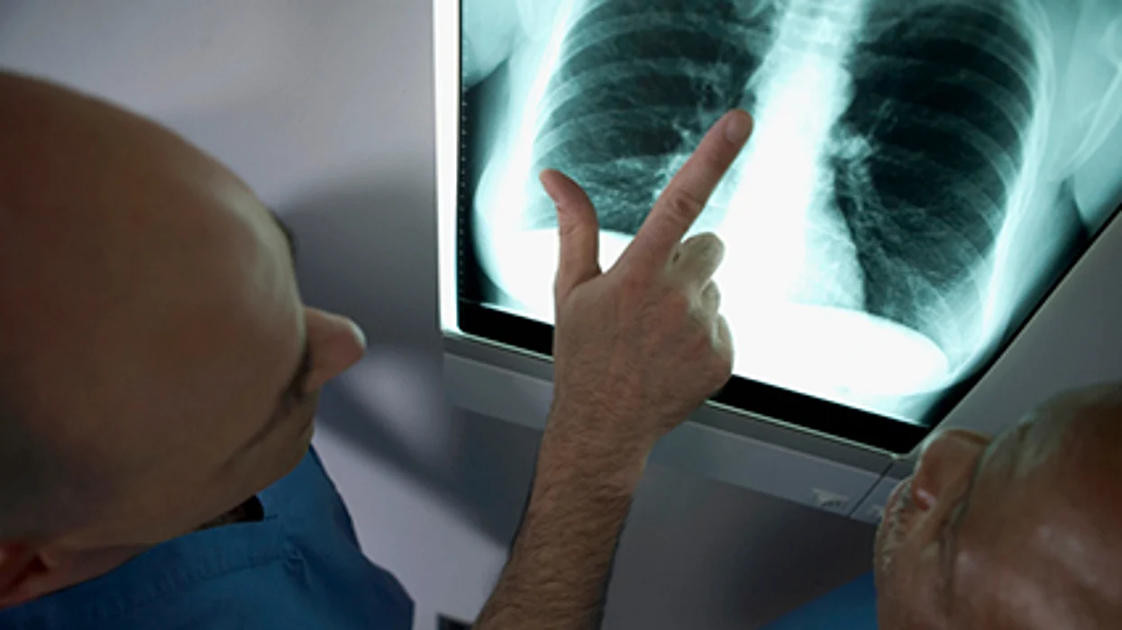 Comida sana pulmones mas sanos