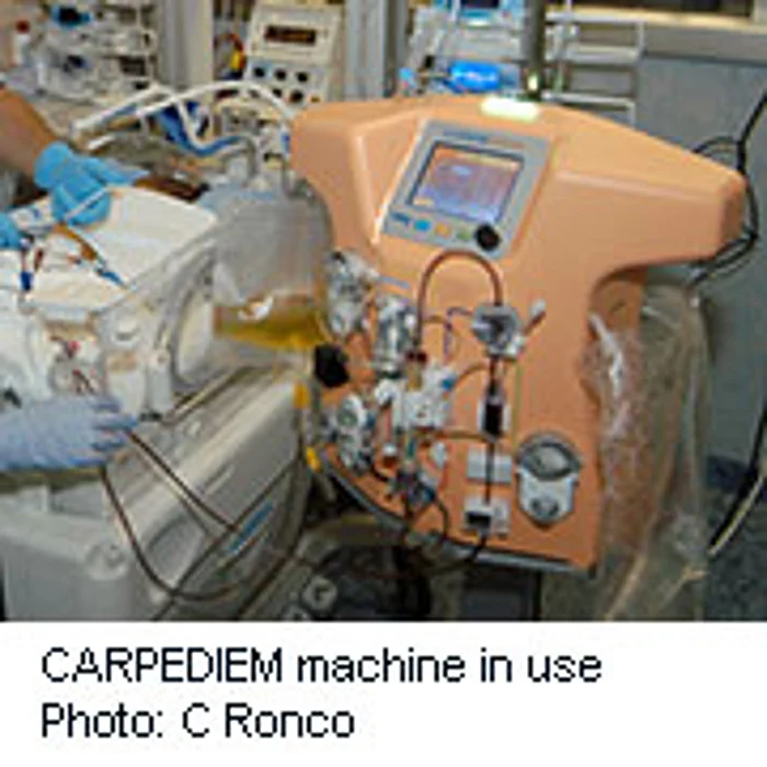 New Dialysis Machine Treats Tiniest of Newborns
