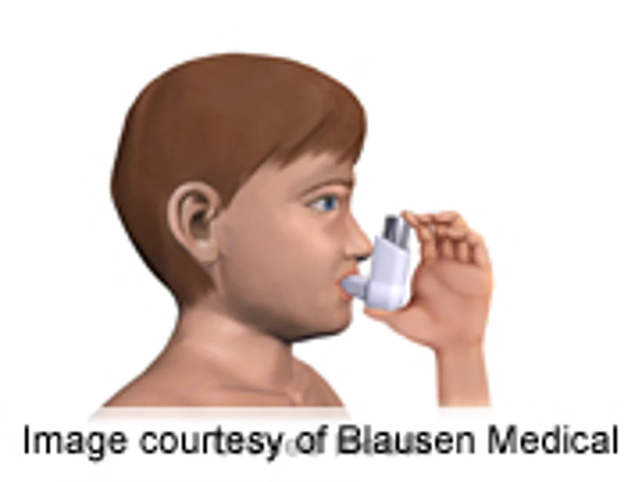 Review: Inhaled Corticosteroids Impact Growth