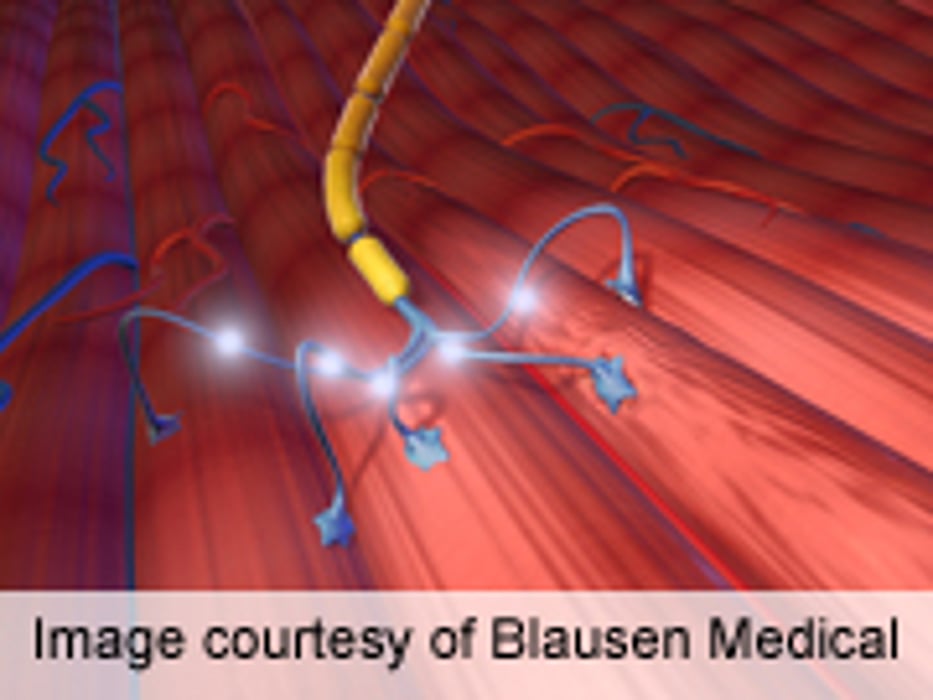 Albumin, Creatinine Blood Tests Might Help Predict ALS Survival