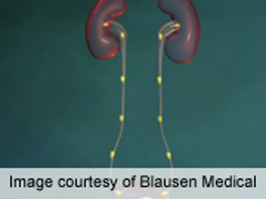 ACP Issues Recurrent Kidney Stone Prevention Guidelines