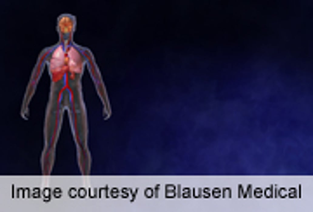 Heat Stroke Bigger Issue Than Cardiac Events in Runners