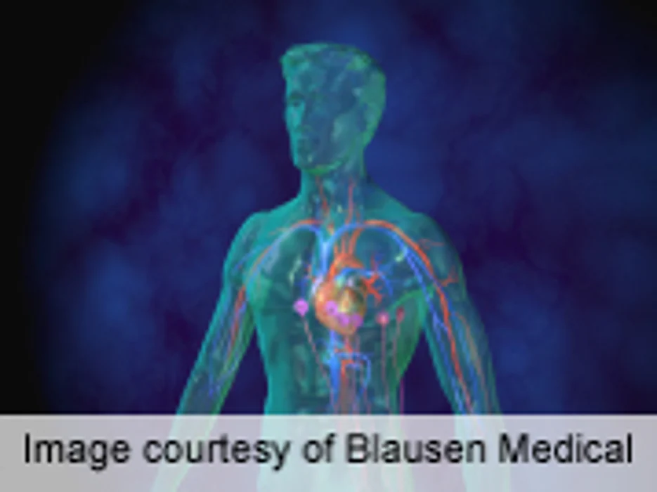 30-Day ECG Monitoring Ups A-Fib Detection After Stroke