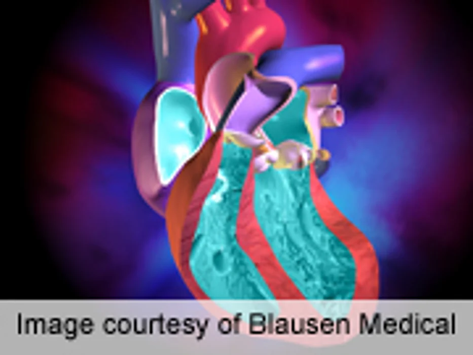 Racial Disparity Seen With Congenital Heart Surgery