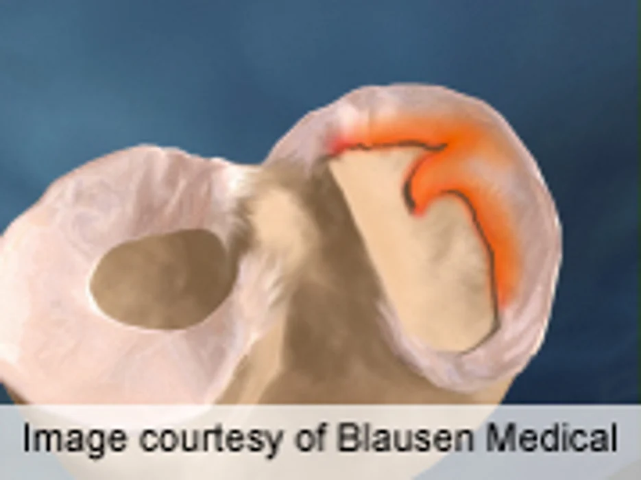 Study Questions Value of Certain Knee Surgeries