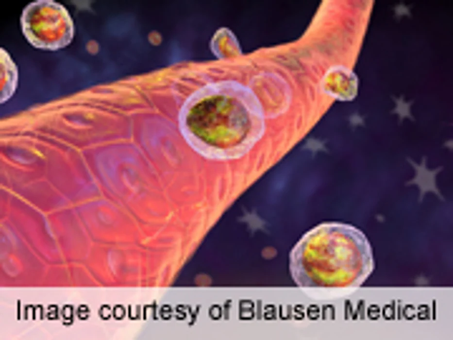 Sensory Deficits Common in Patients With Multiple Myeloma