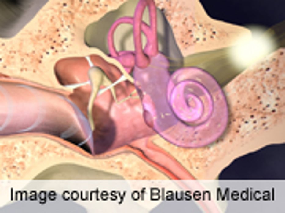 Cleft Lip, Palate Don't Increase Ear Tube Complications