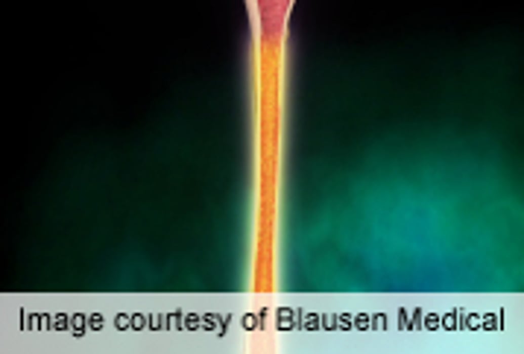 Bisphosphonate Use Ups Atypical Femoral Fracture Risk