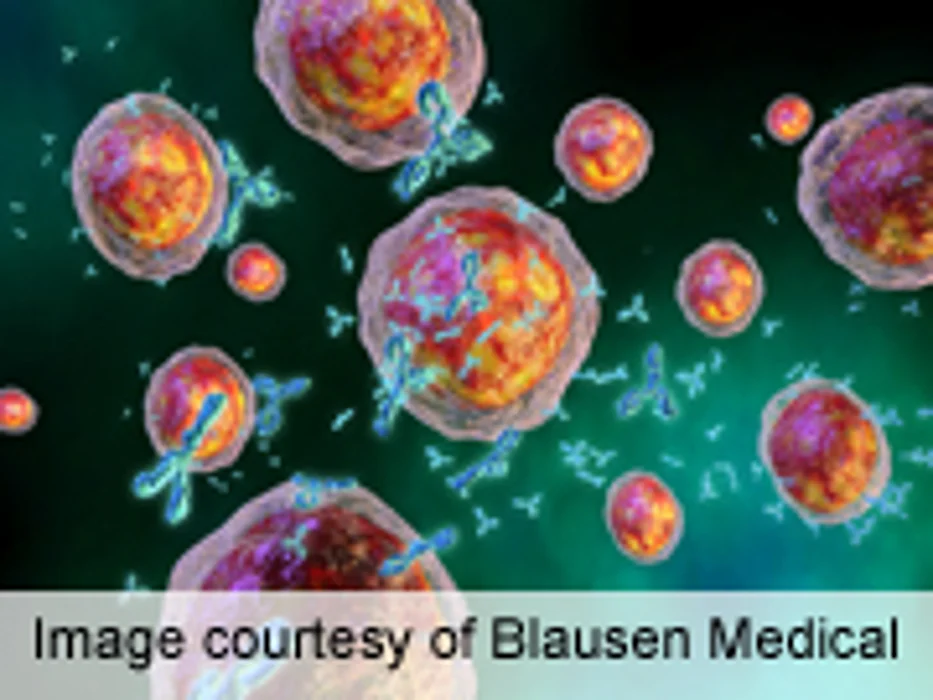 New Myeloma Treatment Options Show Promise
