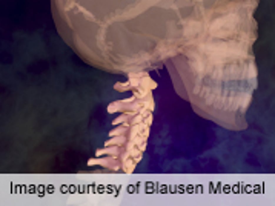 Disk Replacement Preserves Long-Term Spinal Motion