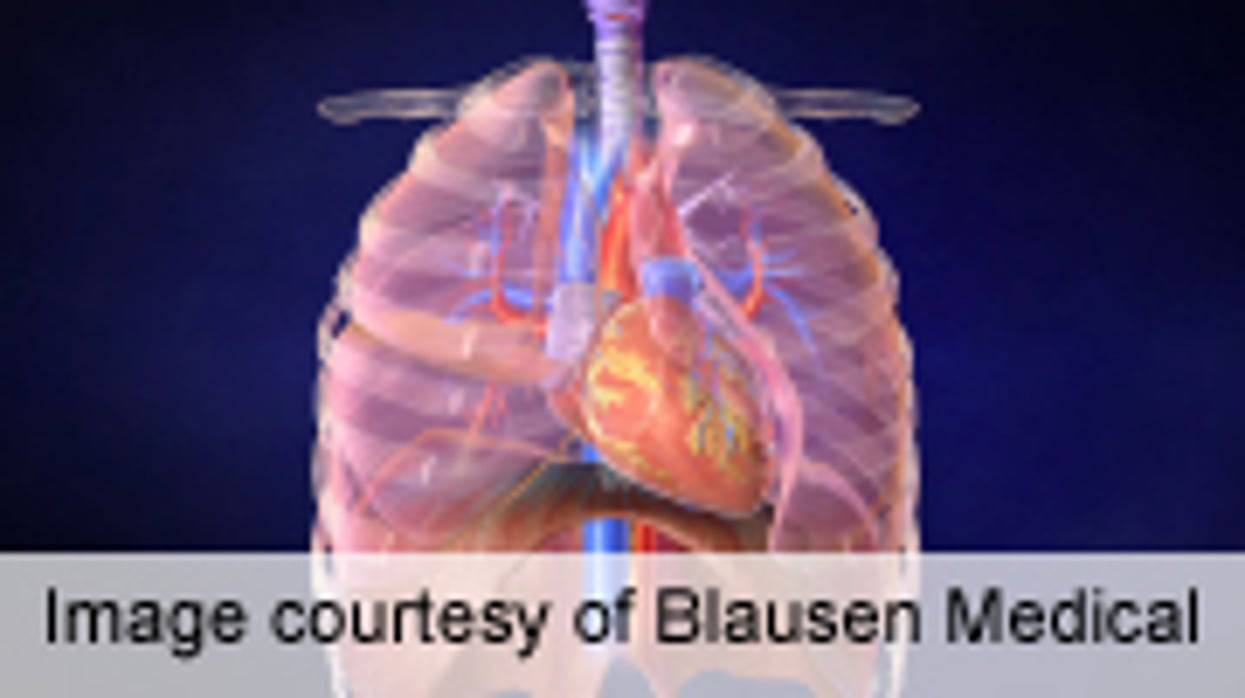 ERS: Benralizumab Doesn't Reduce COPD Exacerbations