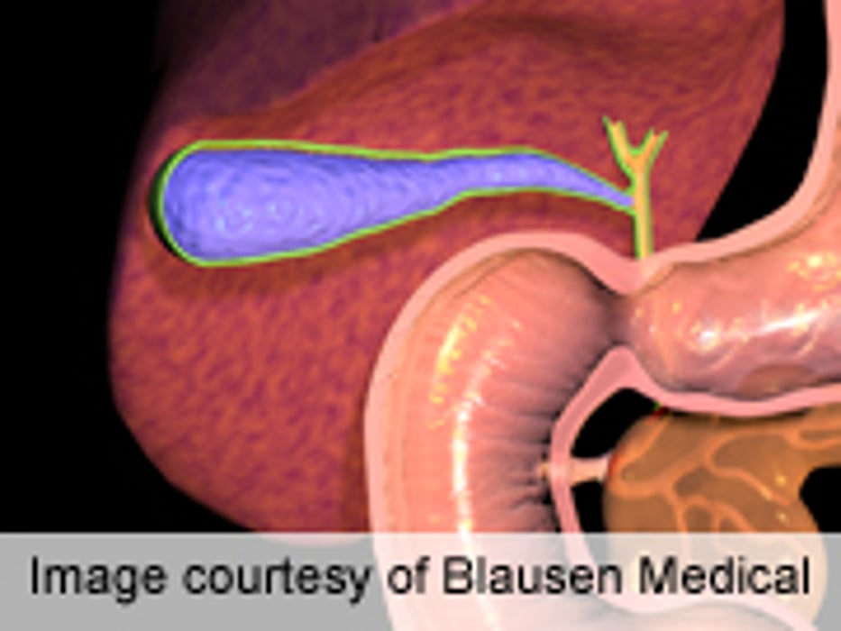Daytime Cholecystectomy May Be Better for Acute Cholecystitis
