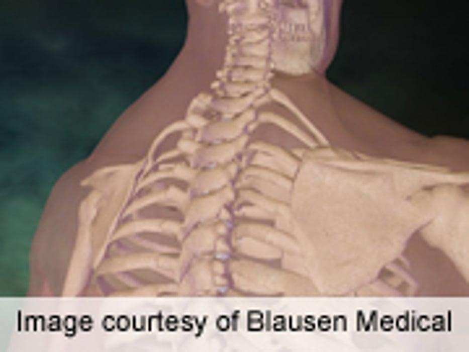 Surgical Site Infections Up for Medicaid Patients With Spine Sx