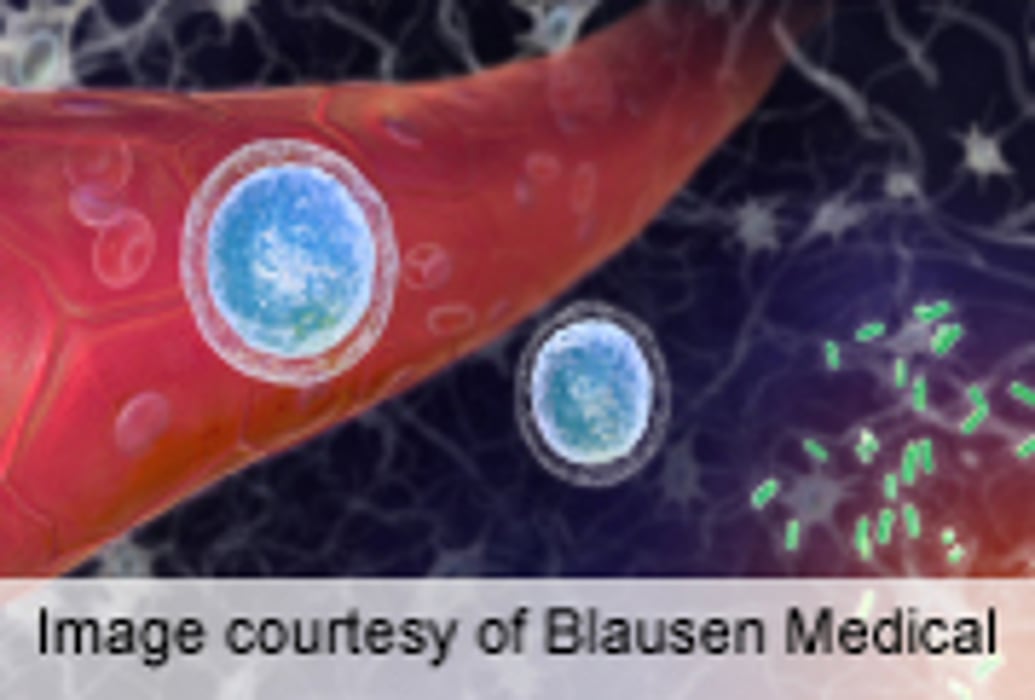 Gene Therapy Shows Potential for Severe Immunodeficiency