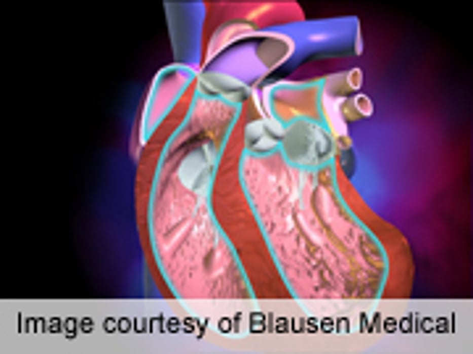 Patient Resources for Ventricular Assist Devices Info Suboptimal