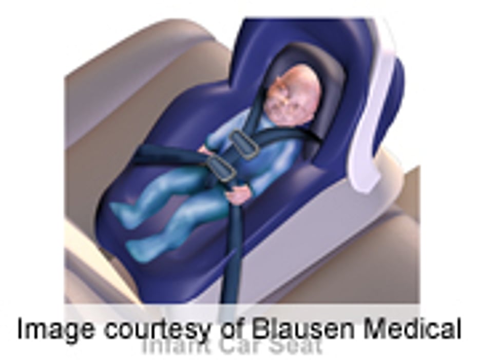 AAP: Many Newborns Have Risky First Ride Home From Hospital
