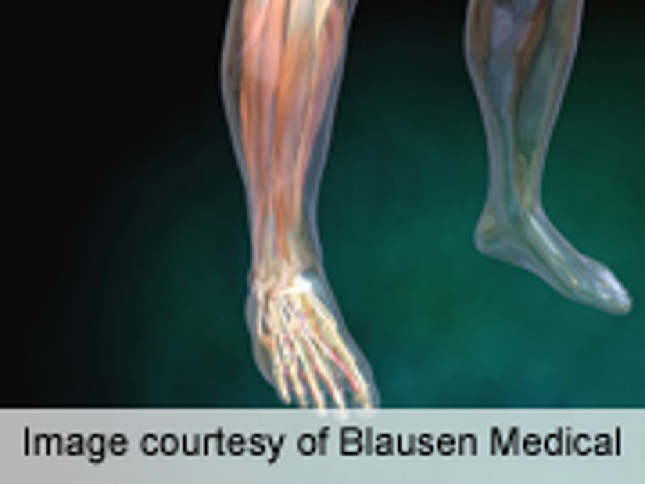 Ankle, Knee Strength Generation Slower With Diabetic Neuropathy