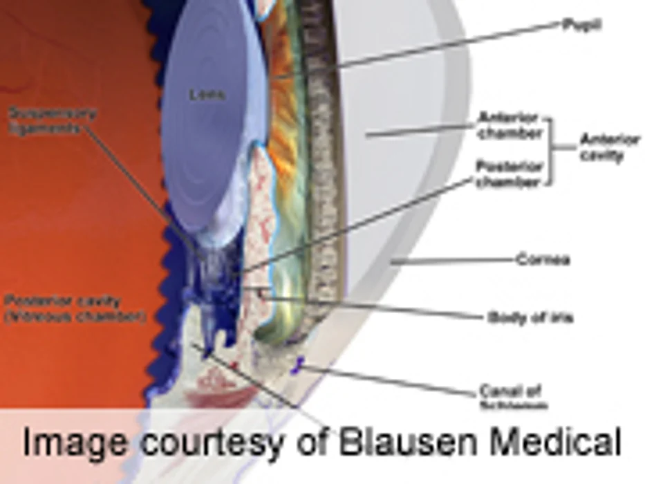 Researchers Probe Molecular Cause for Glaucoma