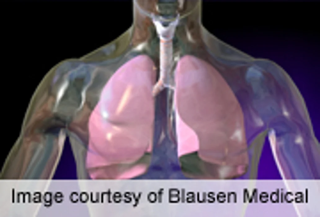 Lung Infections May Hamper Ability to Detect Lung Cancer