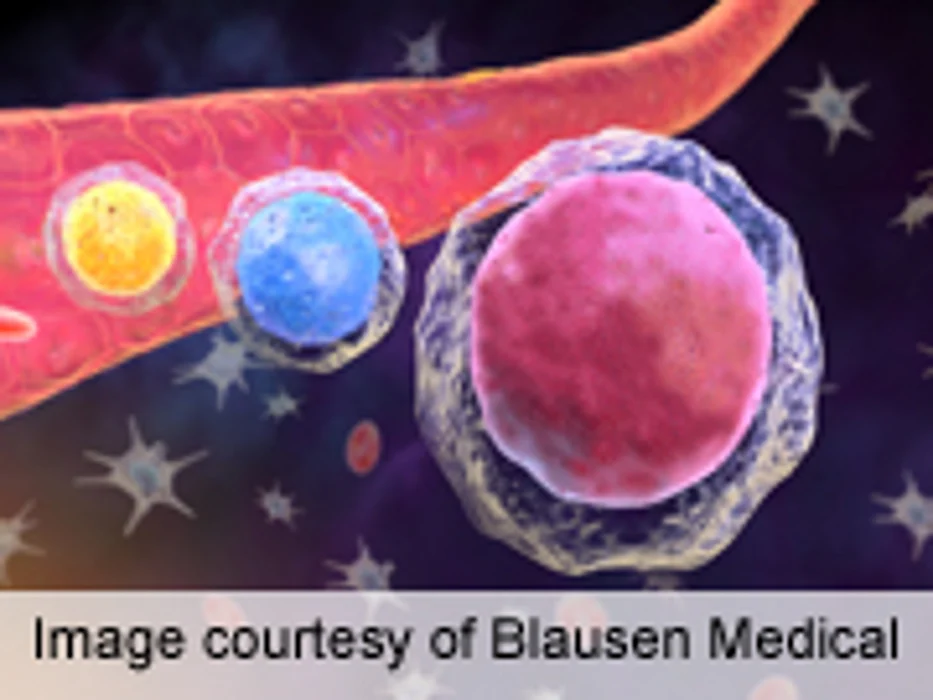 ASH: Carfilzomib Ups Survival in Relapsed Multiple Myeloma